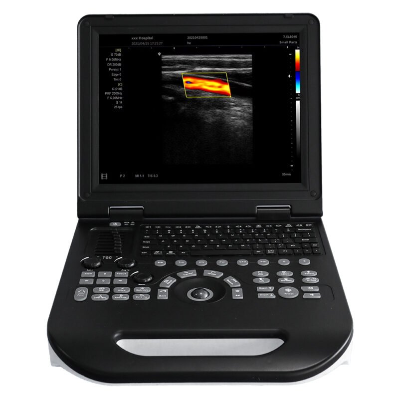 KU30 Color Doppler Ultrasound Diagnostic System