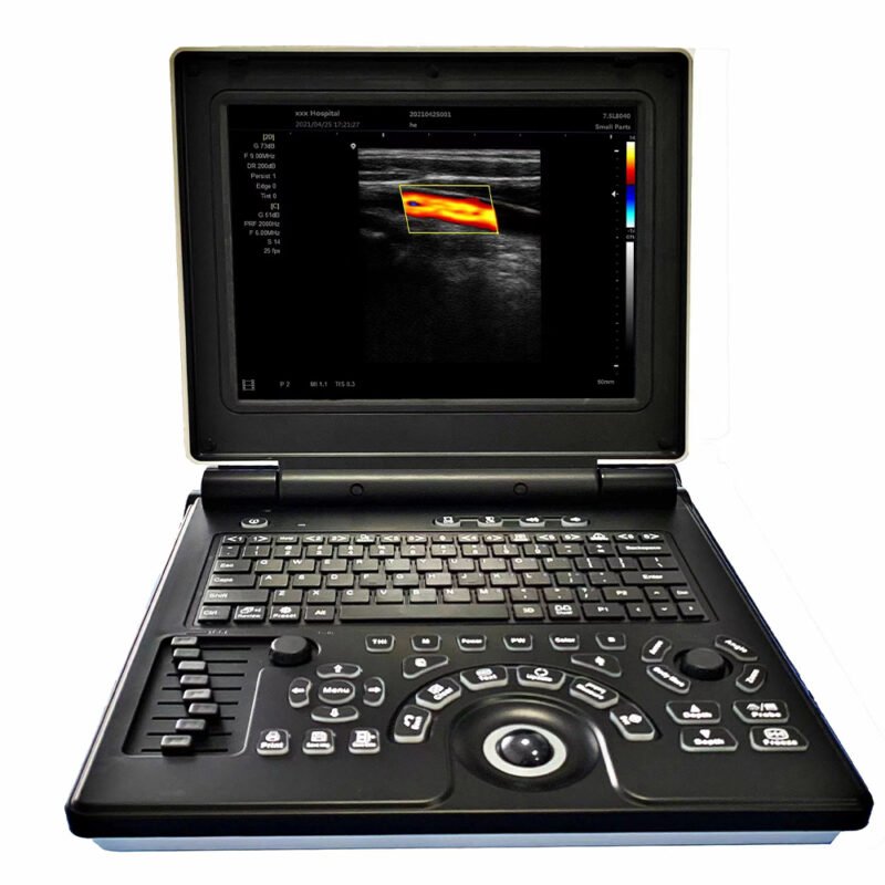 KU20 Ultrasound scanner