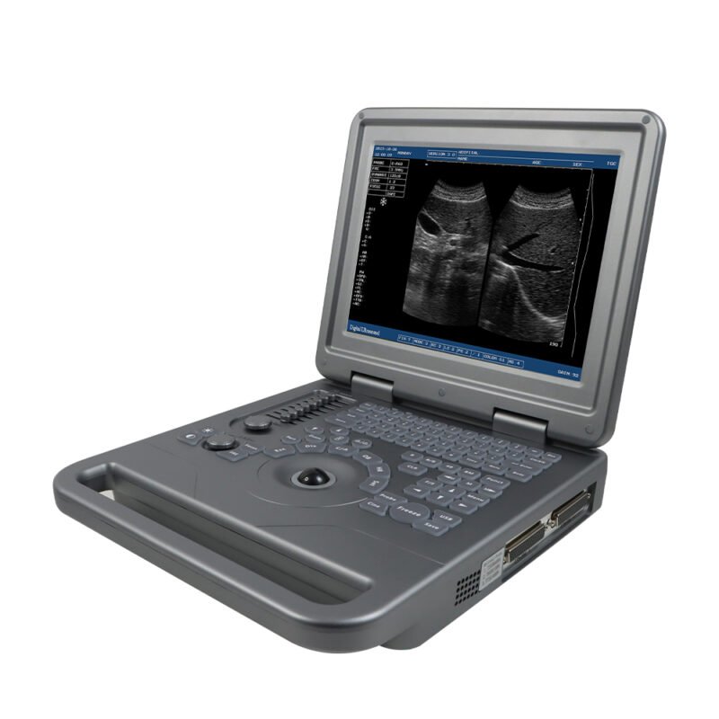 KU50 Ultrasound Diagnostic System